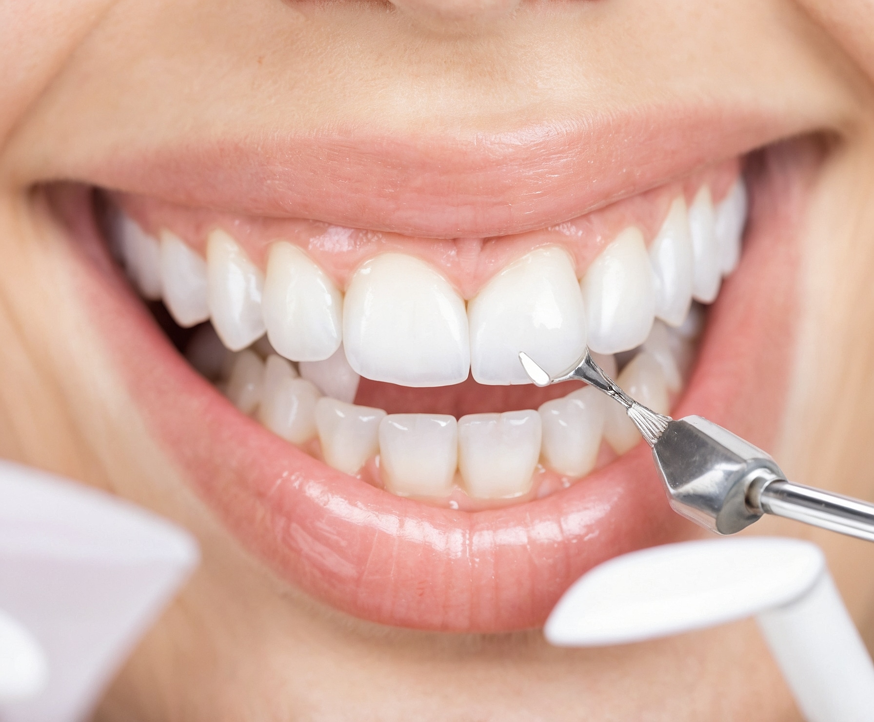 Sonrisa perfecta, transformación estética oral.